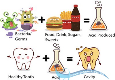 چه غذاهایی باعث کاهش پوسیدگی دندانی می شود