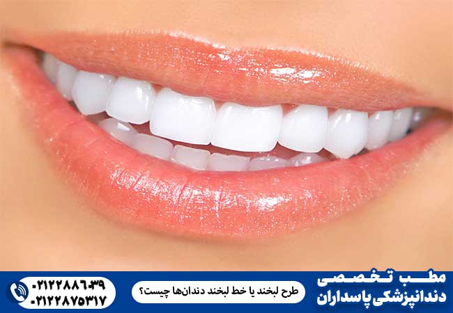 طرح لبخند یا خط لبخند دندان‌ها چیست؟