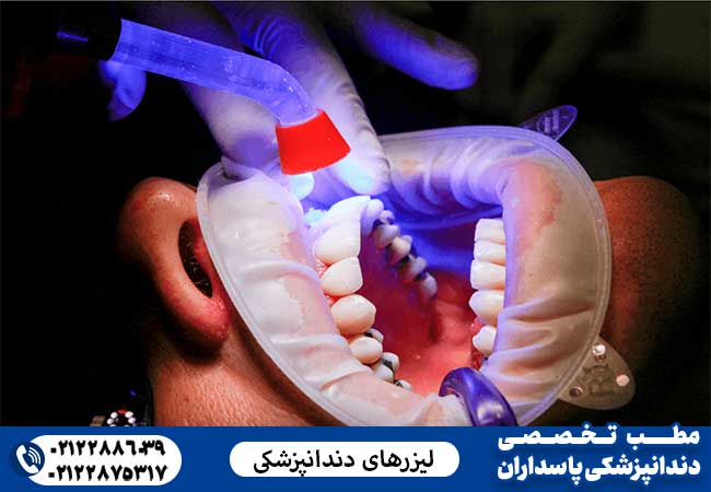 لیزرهای دندانپزشکی: کاربرد و طبقه بندی آن