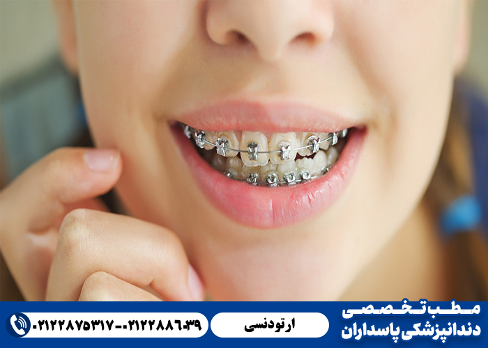 انجام ارتودنسی در کلینیک دندان پزشکی پاسداران