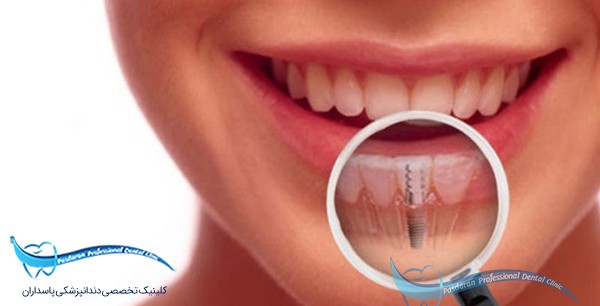 متخصص_پروتزهای_دندانی_و_ایمپلنت_دندانپزشکی_پاسداران