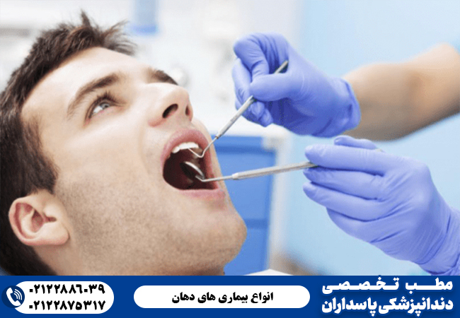 انواع بیماری های دهان را بشناسید