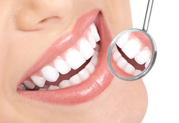 عوامل موثر بر طول عمر لمینت دندان
